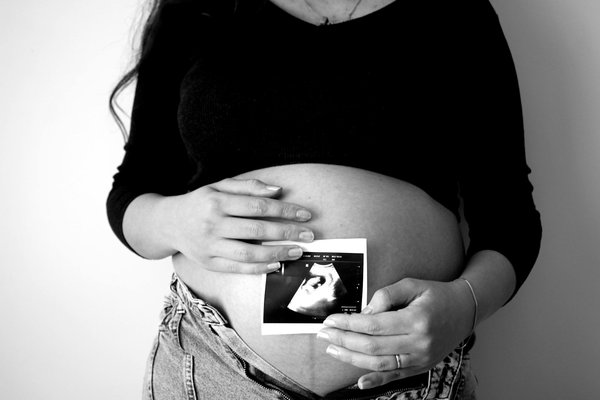 Explorez les secrets de la machine cryolipolyse innovante